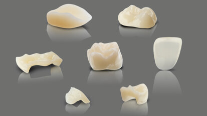 Interview: Fast, affordable and aesthetic 3D-printed dental restorations