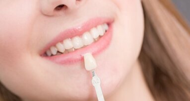 牙科美容市场2020年销售额有望突破220亿美元