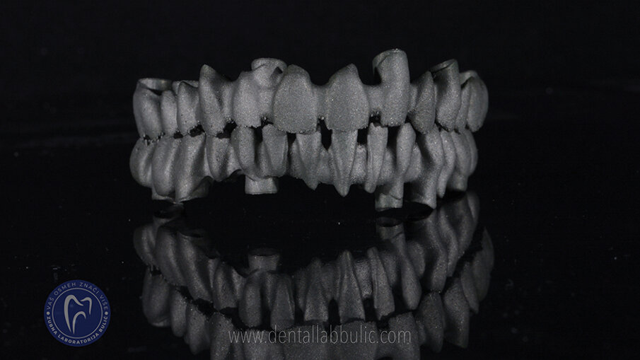 Slika 3 : printani metal u 3D printing centru DDS, za zubnu laboratoriju Bulić