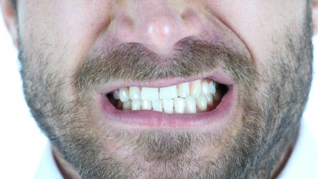 13% onderschat negatieve effecten tandenknarsen