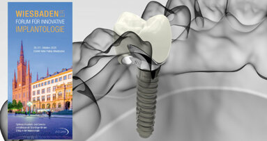 Wiesbadener Forum für Innovative Implantologie im Oktober