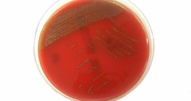 Une bactérie sur les muqueuses buccales pourrait provoquer des maladies graves si elle passe dans le sang