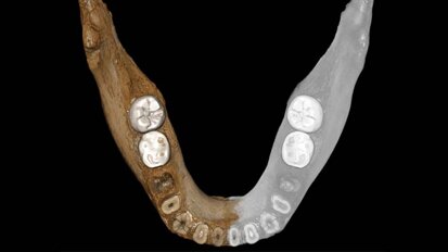 Mandible helps to uncover history of civilisations in Tibet