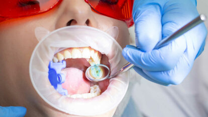 Prevalência de cárie dentária continua a afetar adultos australianos, diz estudo