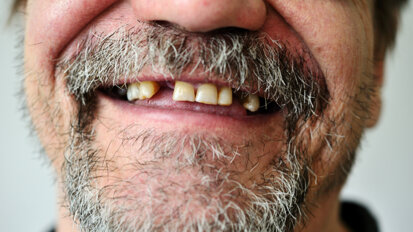 Dois estudos separados revelam um futuro emocionante na bioengenharia de dentes