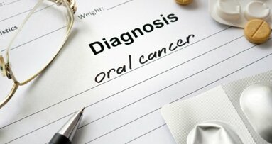 Aumento do câncer oral nos EUA