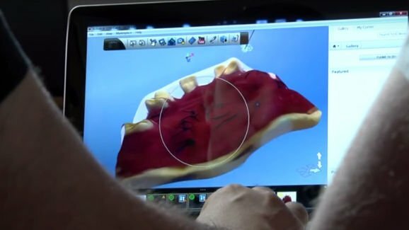 全新3D全息扫描仪有效缩短全口义齿的固位稳定过程