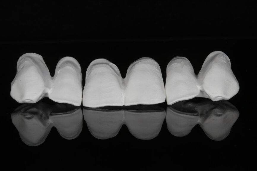 Fig. 1: Pre-sintered anatomically reduced crowns after milling.