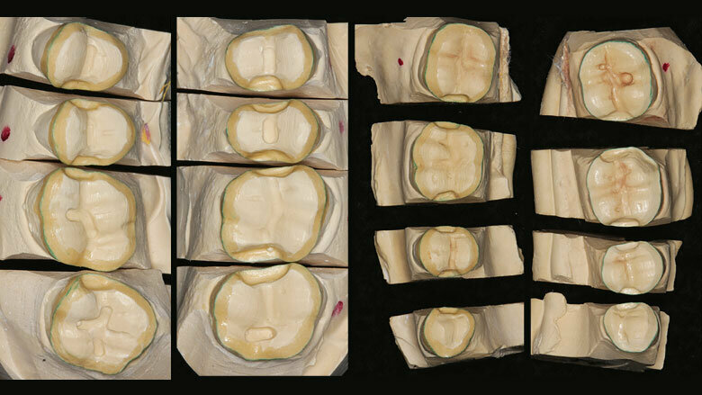 Figure 5: Models of prepared posterior teeth
