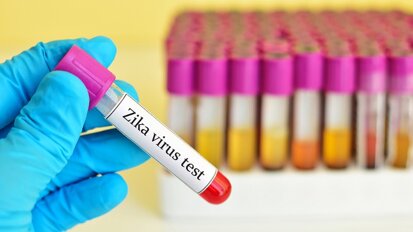 Researchers test new means of Zika diagnosis