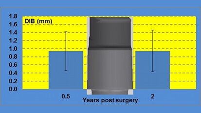 Performance clinique et radiologique des implants courts (L 6,5 mm). Résultats d’une étude clinique incluant un suivi de 2 ans