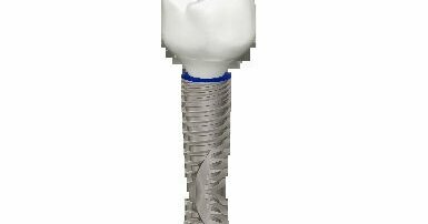 Aurea®