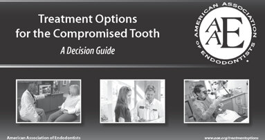 Endodontics before extraction: AAE resource illustrates treatments that save the natural tooth
