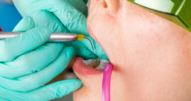 BIOLASE and DCA plan to expand laser adoption in dental offices