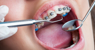 German health insurers could scrap payment for fixed orthodontic appliances