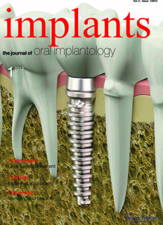 implants UK No. 1, 2012