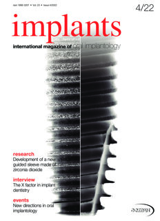 implants-international-no-4-2022