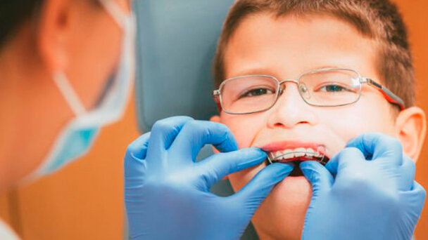 L’obesità può influenzare la risposta al trattamento ortodontico nei minori