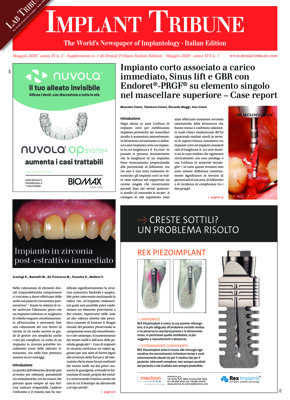 Implant Tribune Italy No.2, 2020