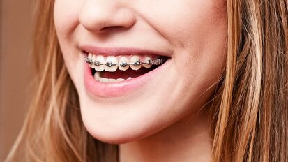Beugelende tandarts wordt ‘tandarts voor orthodontie’