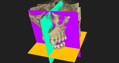 Tomografia stożkowa – innowacyjny system obrazowania