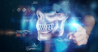 S2k-Leitlinie „Dentale digitale Volumentomographie“ wurde aktualisiert