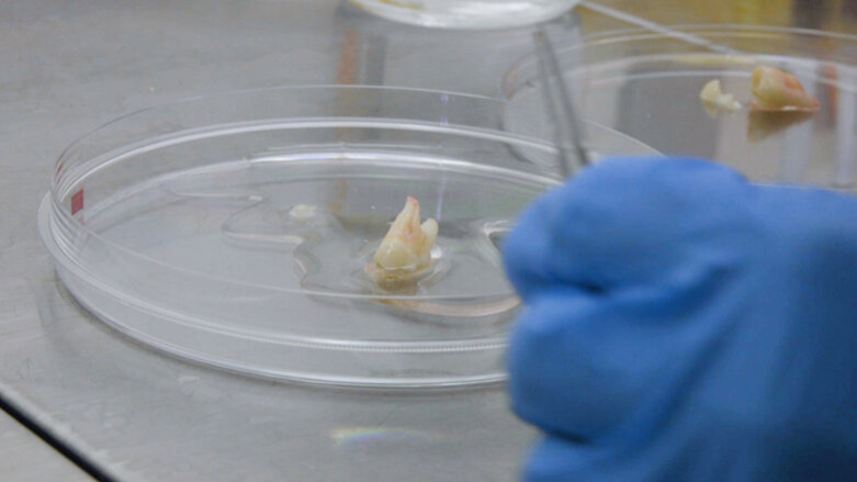 Researchers investigate possibility of regrowing teeth