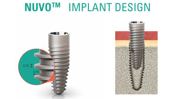 Tapered Implants: Designing original to boost primer stability
