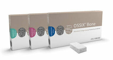 OSSIX Bone maakt botopbouw eenvoudiger