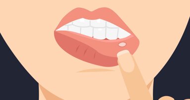 Gefährdung der Krebsbehandlung durch Entzündungen der Mundschleimhaut