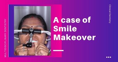 A minimally invasive smile makeover: an orthodontic-restorative approach.
