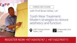 Tooth Wear Treatment: Modern strategies to restore aesthetics and function.