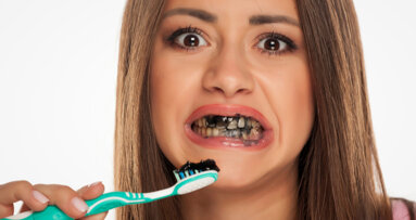 Dentists discourage the use of charcoal toothpaste