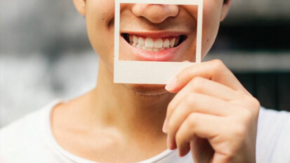 Why dental veneers are not without risk
