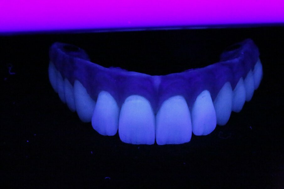 Fig. 13b: Light dynamics of natural teeth under fluorescent light.