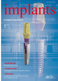 implants-france-no-1-2013-0113