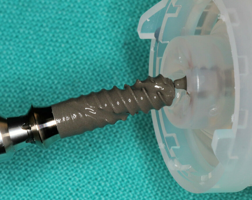 Fig. 12: Direct implant pick-up with insertion driver.