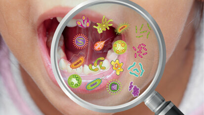 Forscher: Bakterien im Mund können depressiv machen
