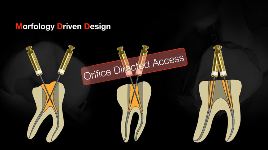 Rethinking endodontic access using a conservative approach. (Image: Dr Eugen Buga)