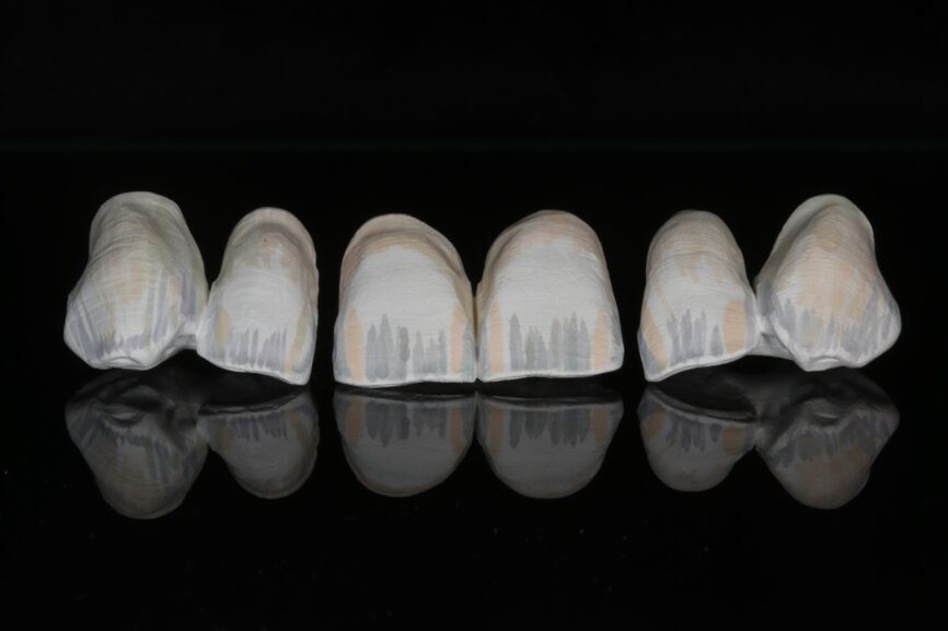 Fig. 2: Esthetic Colorant applied to the milled restorations.