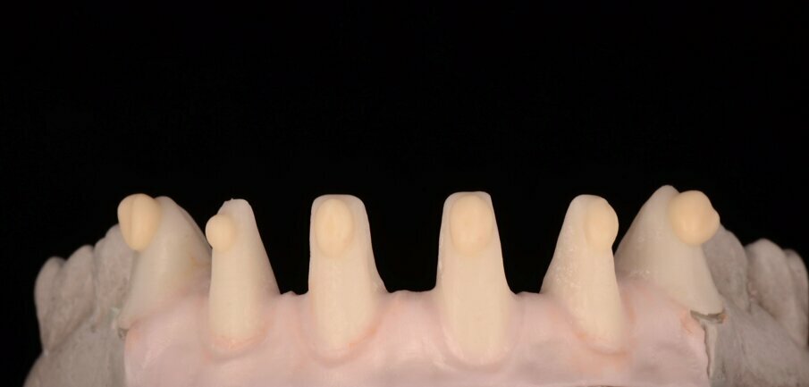 Fig. 25: Highly uid GC Initial LiSi ceramic is applied to the zirconia framework.