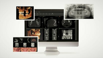 Anwendung und Nutzen der digitale Volumentomografie in der allgemeinen Zahnheilkunde
