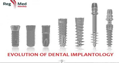 Curriculum for Immediate Loading in Dental Implantology