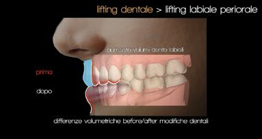 Logopedia Estetica Funzionale: quali sinergie con l’odontoiatria e la medicina estetica?