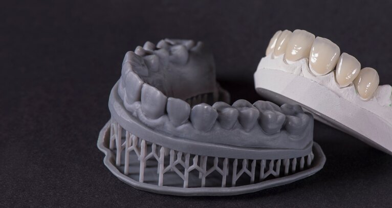 3D printing: Revolution in dentistry