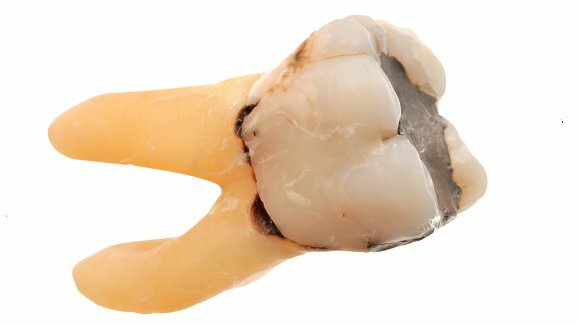 Couple finds human tooth in sausage
