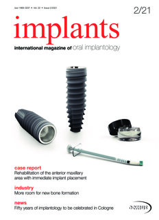 implants international No. 2, 2021