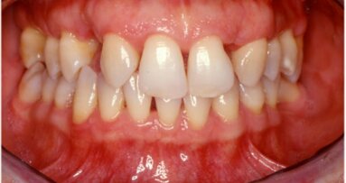 Il ruolo dell’ortodonzia nei trattamenti interdisciplinari