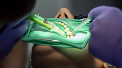 Is root canal therapy not so painful after all?