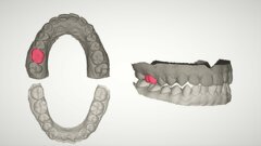 在最近的一項實驗研究中，香港研究人員證明，他們的AI系統可以根據剩餘牙列的特徵生产磨牙义齿（紅色）的設計。 （图片：HKU）
